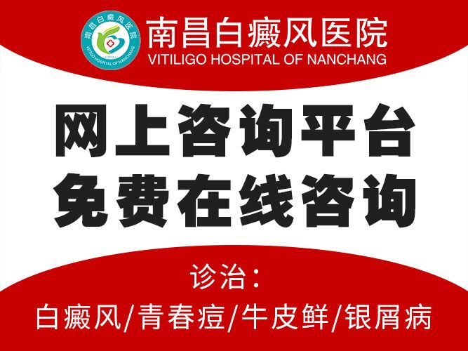 南昌医院好治疗白癜风方法-口碑榜推荐!南昌治疗白癜风去哪家医院”前三强”具体排名