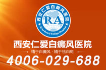 排名出炉！西安有哪些专治白癜风的医院"排行前列"白癜风类型怎么分辨